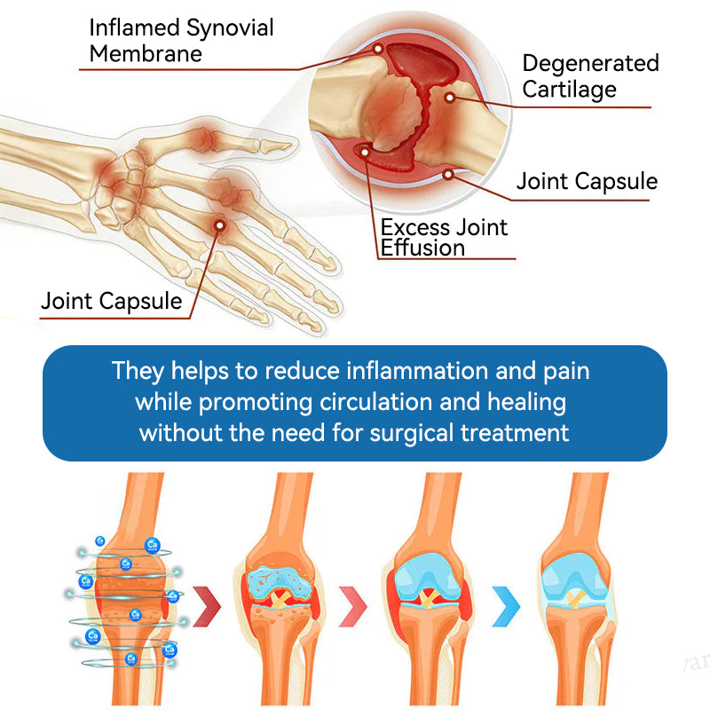 CleraNaure® BPC-157 関節治療クリーム🦴 関節炎、神経障害、リウマチ、スポーツ障害などの治療に