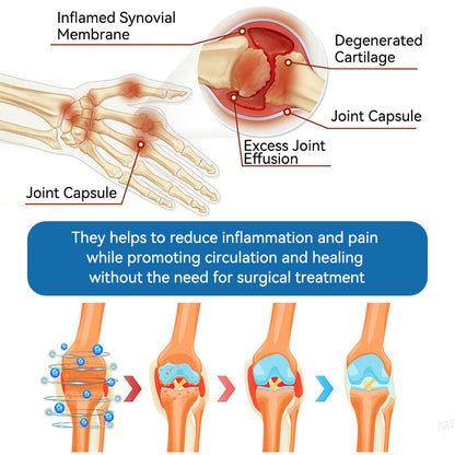CleraNaure® BPC-157 関節治療クリーム🦴 関節炎、神経障害、リウマチ、スポーツ障害などの治療に