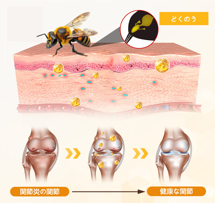 CleraLuxe® ビーベノム 関節ケア＆リペアクリーム 〜しなやかな動きへ〜
