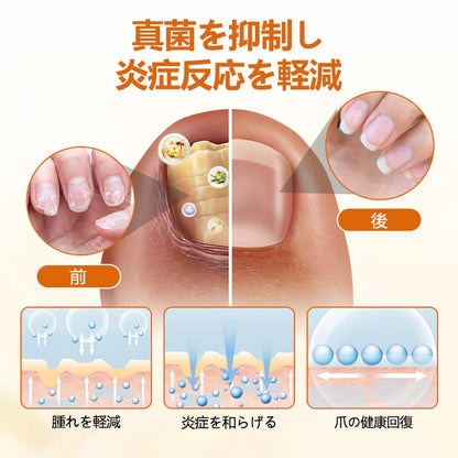 CleraNaure® FungiBee Advanced ネイルリペアスプレー