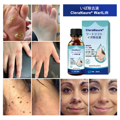 CleraNaure® ワートリフト とうもろこし除去液