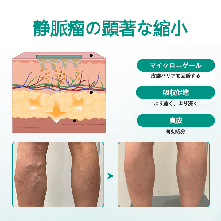 CleraNaure® LegRenew 静脈瘤ケアパッチ