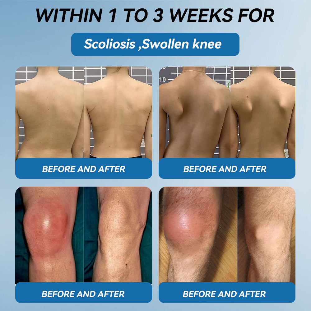 CleraNaure® BPC-157 関節治療クリーム🦴 関節炎、神経障害、リウマチ、スポーツ障害などの治療に