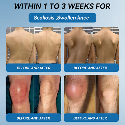 CleraNaure® BPC-157 関節治療クリーム🦴 関節炎、神経障害、リウマチ、スポーツ障害などの治療に