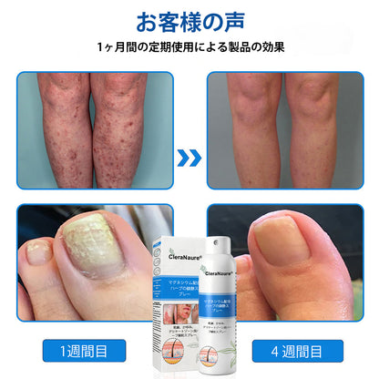 CleraNature® マグネシウムスプレー – かゆみ、赤み、敏感肌の即効リリーフ（デリケートゾーンにも対応）