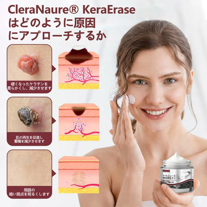 ⭐🏅CleraNaure®🏅🏅 🏅ケラエレース デュアルアクション再生クリーム 公式オンラインショップ - 肌再生のためのデュアルアクションクリーム（デュアルアクション再生 – 隆起した膨らみを滑らかにし、酸や刺激なしで深い角質の蓄積を分解)