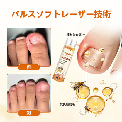 CleraNaure® FungiBee Advanced ネイルリペアスプレー