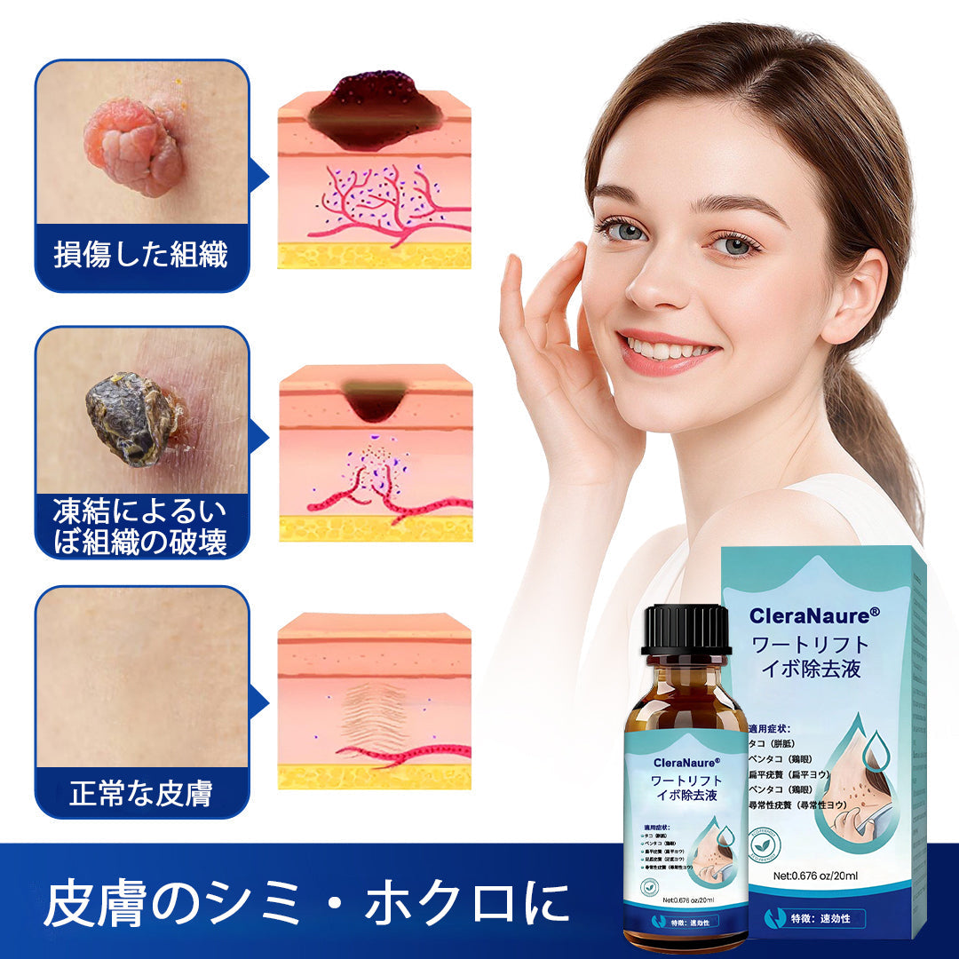 CleraNaure® ワートリフト とうもろこし除去液