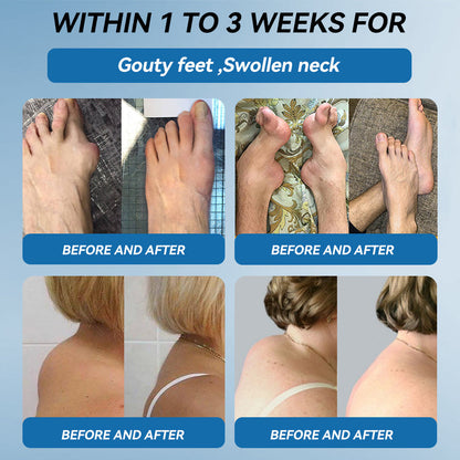 CleraNaure® BPC-157 関節治療クリーム🦴 関節炎、神経障害、リウマチ、スポーツ障害などの治療に