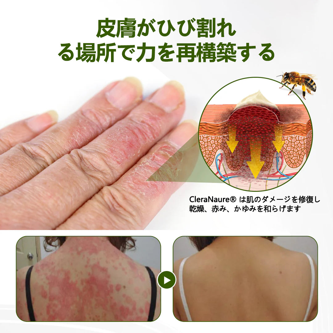 CleraNaure® ビーペプチド ルートソフト デュアルリリーフ クリーム