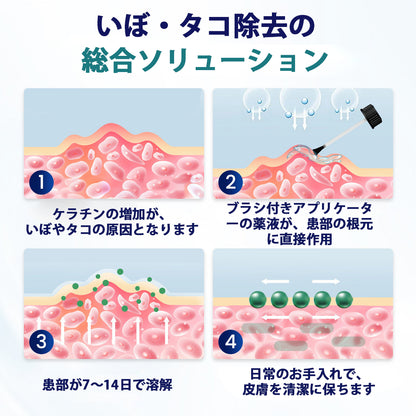 CleraNaure® ワートリフト とうもろこし除去液