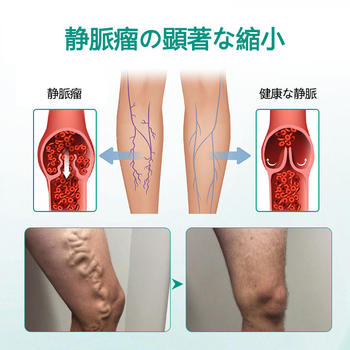 CleraNaure® LegRenew 静脈瘤ケアパッチ