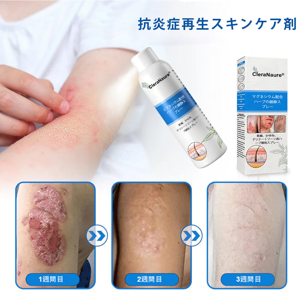 CleraNature® マグネシウムスプレー – かゆみ、赤み、敏感肌の即効リリーフ（デリケートゾーンにも対応）