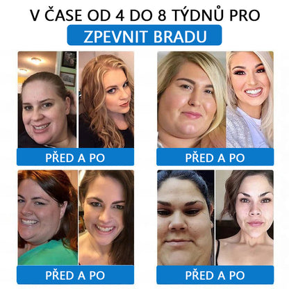 ⭐⭐⭐CleraNaure® 7-in-1 メタボリック＆シェイプアップパッチ（マイクロディフュージョン技術、24時間効果）体重管理、食欲、エネルギー、血糖代謝のためのパッチ💡💡