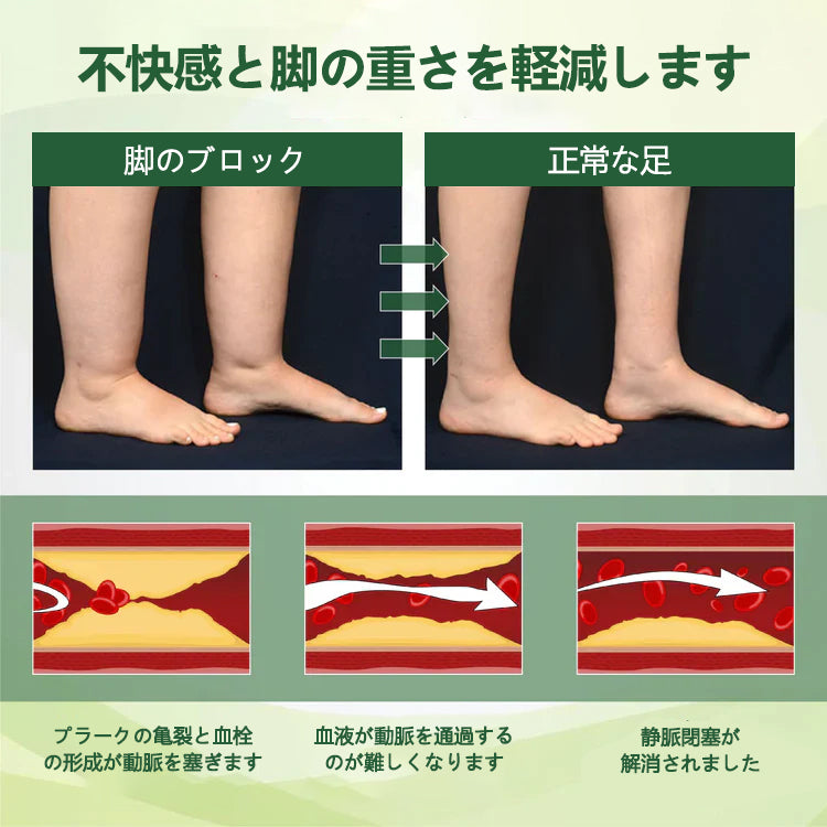 🌿腫れた痛む足にさよならを告げましょう – CleraNaure® FluidEase 脚の血行促進用プロフェッショナルクリームが本物の安心感をお届けします！ ✨🦵