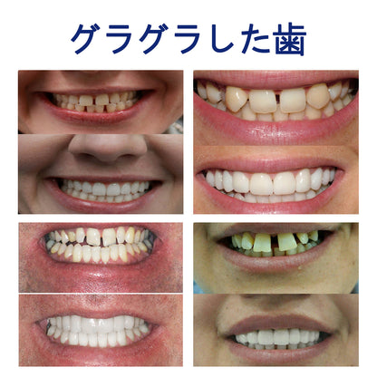 CleraLuxe®シリコーン義歯定規セット（✅ 試験済み・信頼の品質・歯科医師推奨）🔥