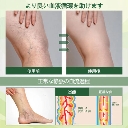 🌿腫れた痛む足にさよならを告げましょう – CleraNaure® FluidEase 脚の血行促進用プロフェッショナルクリームが本物の安心感をお届けします！ ✨🦵