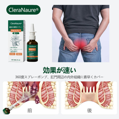🎁🎁 限定キャンペーン | CleraNaure® 速効性痔疾用PROスプレー🎁