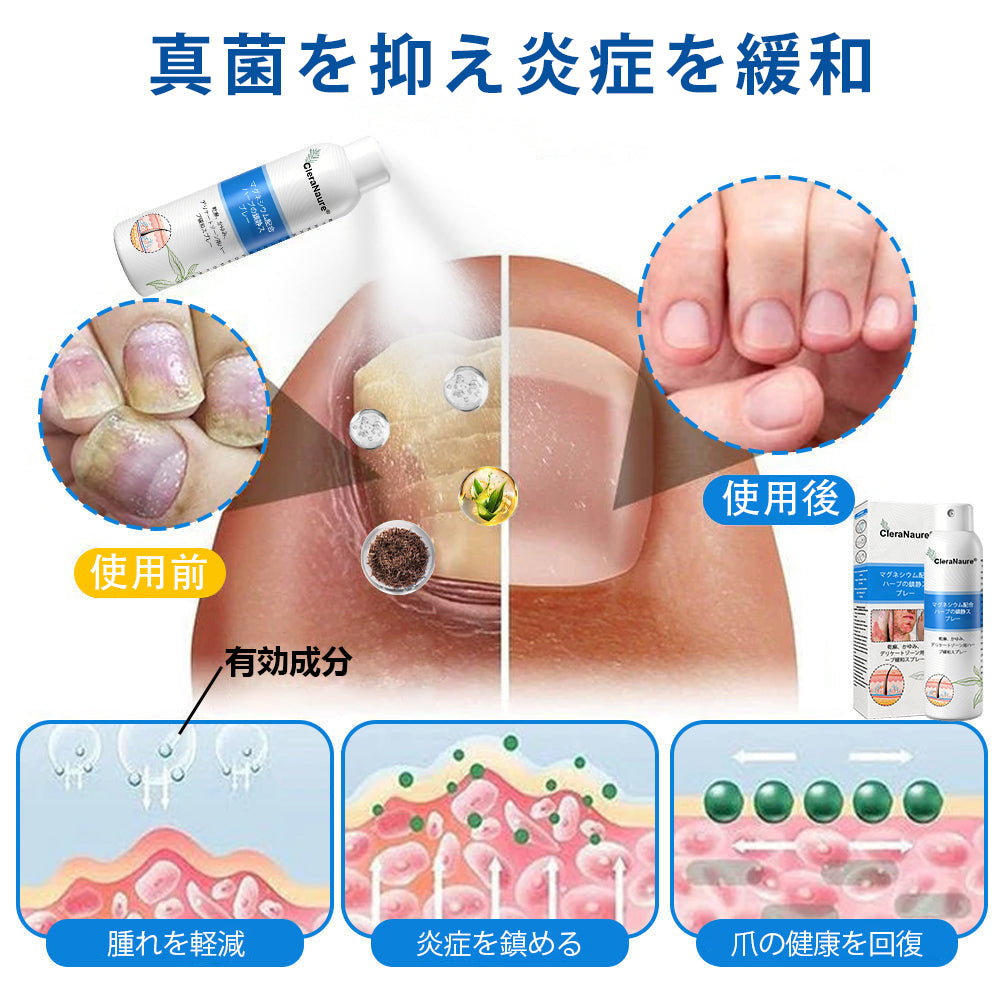 CleraNature® マグネシウムスプレー – かゆみ、赤み、敏感肌の即効リリーフ（デリケートゾーンにも対応）