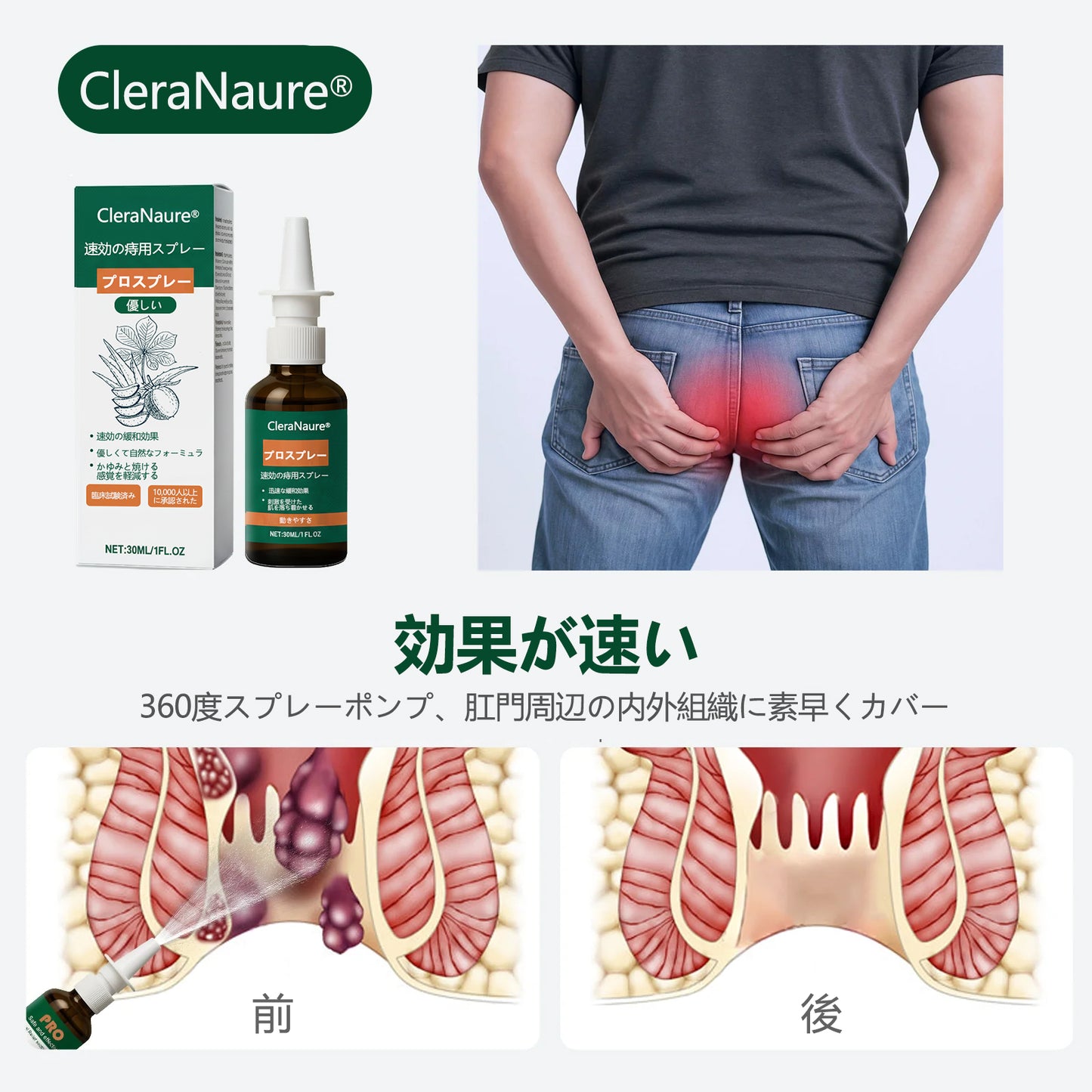🎁 限定キャンペーン | CleraNaure® 速効性痔疾用PROスプレー