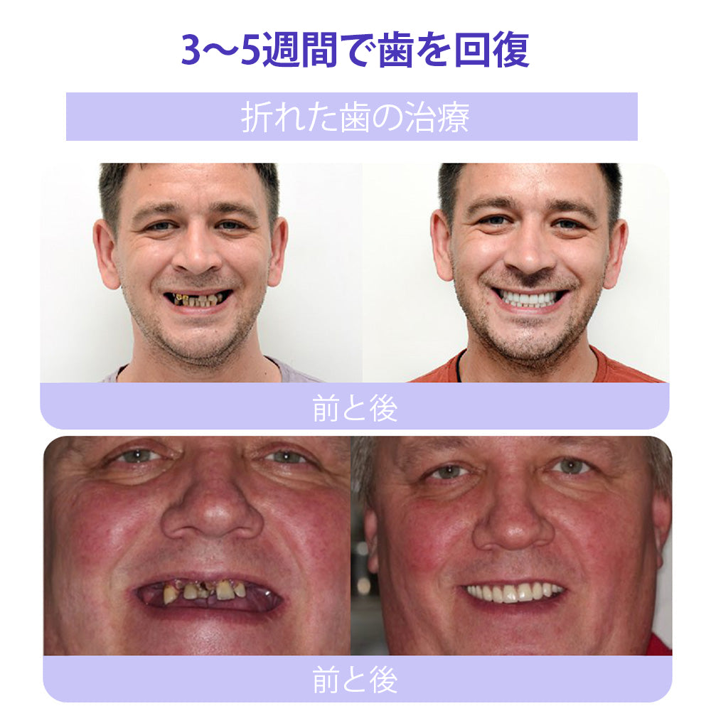 CleraNature® 歯の修復ミネラルパウダー