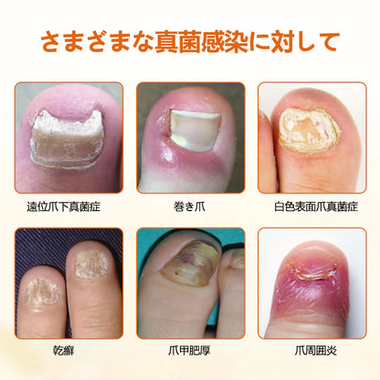 CleraNaure® FungiBee Advanced ネイルリペアスプレー