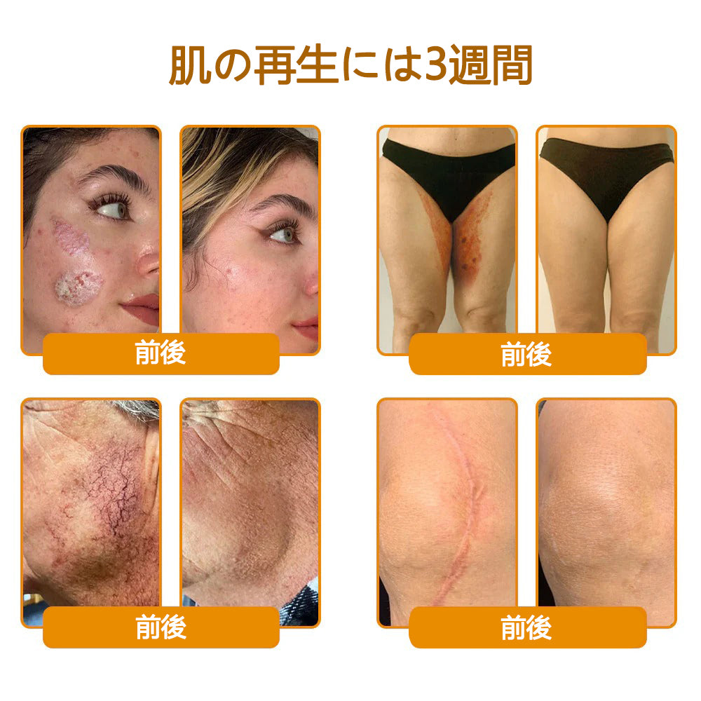 CleraNaure® ミツバチ毒スキンレストレーションクリーム