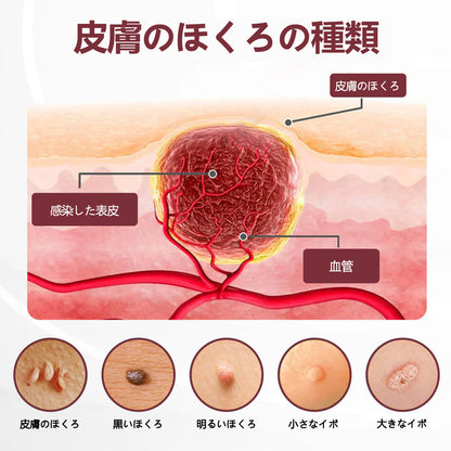 ⭐🏅🏅CleraNaure®🏅🏅 🏅ケラエレース デュアルアクション再生クリーム 公式オンラインショップ - 肌再生のためのデュアルアクションクリーム（デュアルアクション再生 – 隆起した膨らみを滑らかにし、酸や刺激なしで深い角質の蓄積を分解)