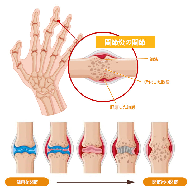 CleraLuxe® ビーベノム 関節ケア＆リペアクリーム 〜しなやかな動きへ〜